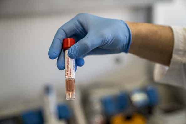 A lab worker shows a vial containing an infected suspect's swab during the coronavirus swab test process at a laboratory in Amedeo di Savoia hospital in Turin